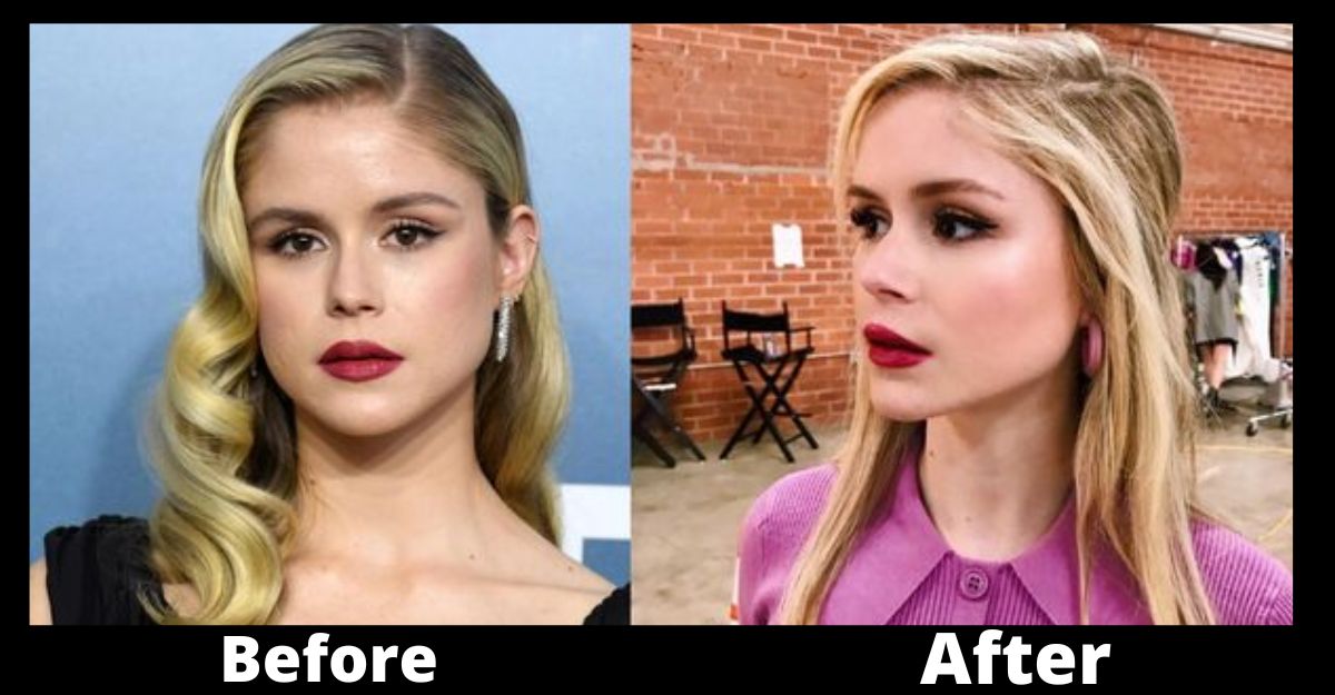 Erin Moriarty Plastic Surgery