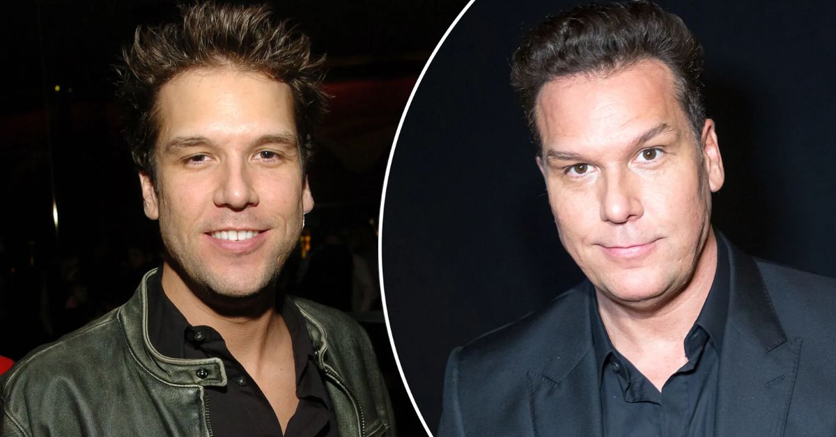 Dane Cook Plastic Surgery