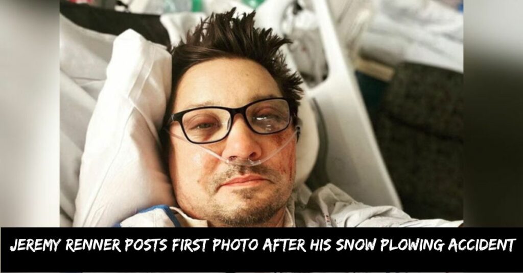 Jeremy Renner Posts First Photo After His Snow Plowing Accident