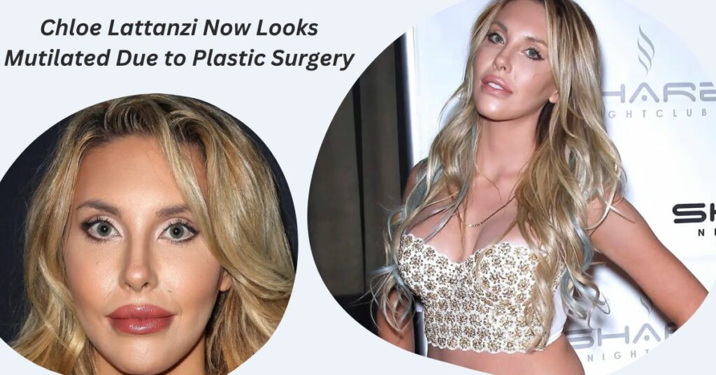 Chloe Lattanzi Claims That She Now Looks Mutilated Due to Plastic Surgery