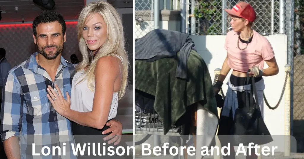 Loni Willison Before and After
