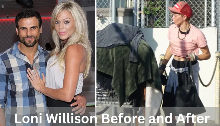 Loni Willison Before and After