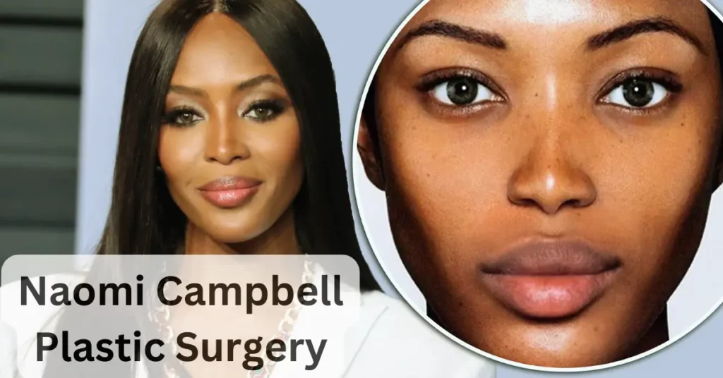 Naomi Campbell Plastic Surgery
