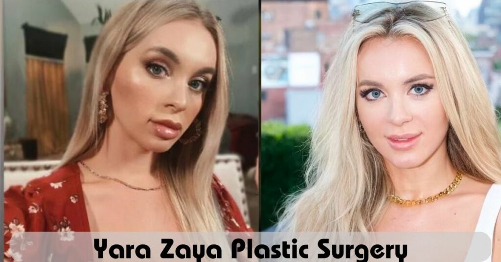 Yara Zaya Plastic Surgery