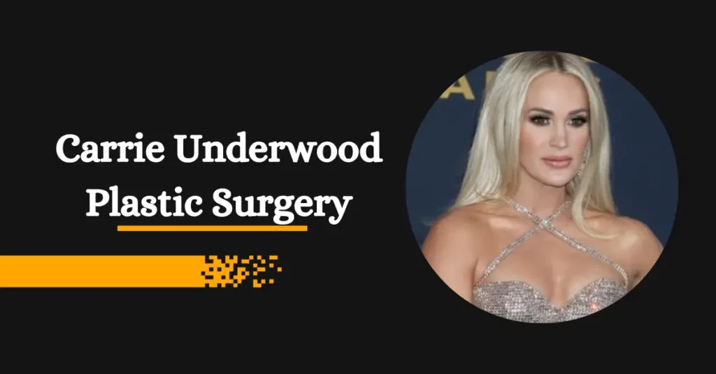 Carrie Underwood Plastic Surgery