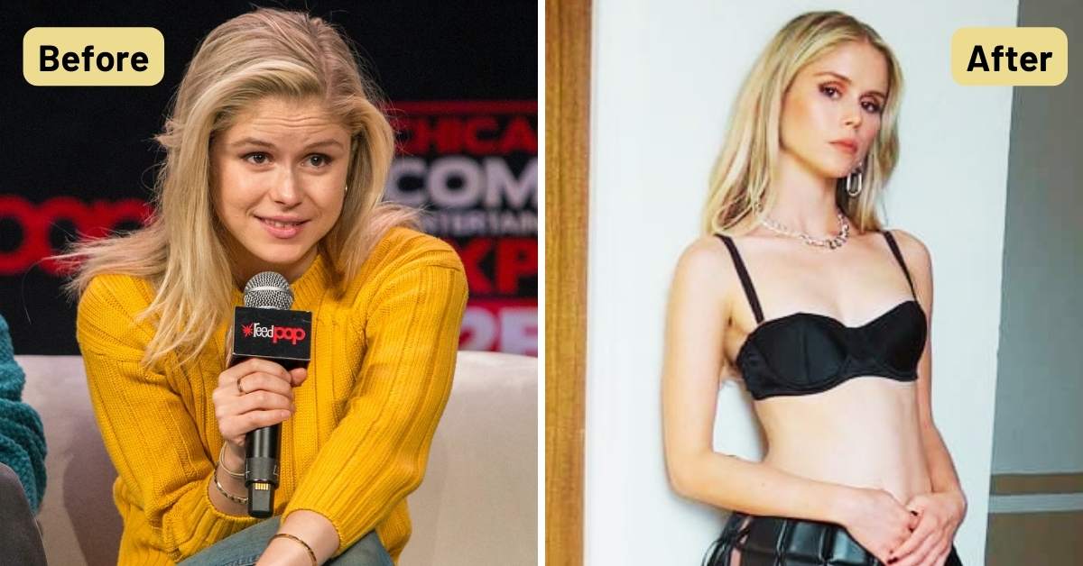Erin Moriarty Before and After Plastic Surgery