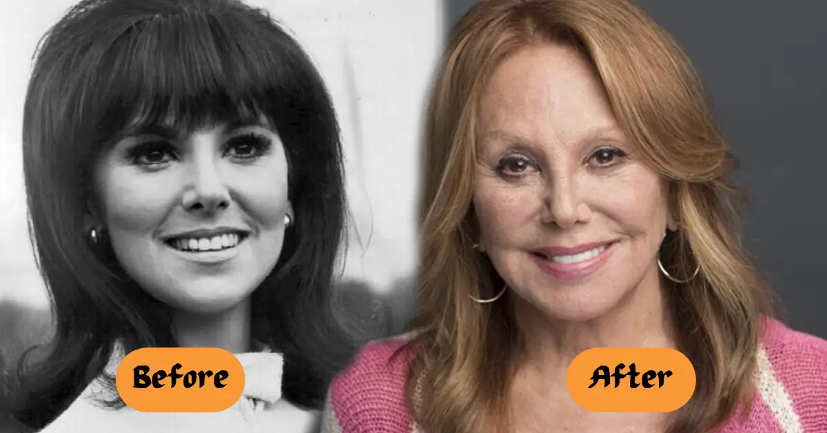 What Happened To Marlo Thomas Face