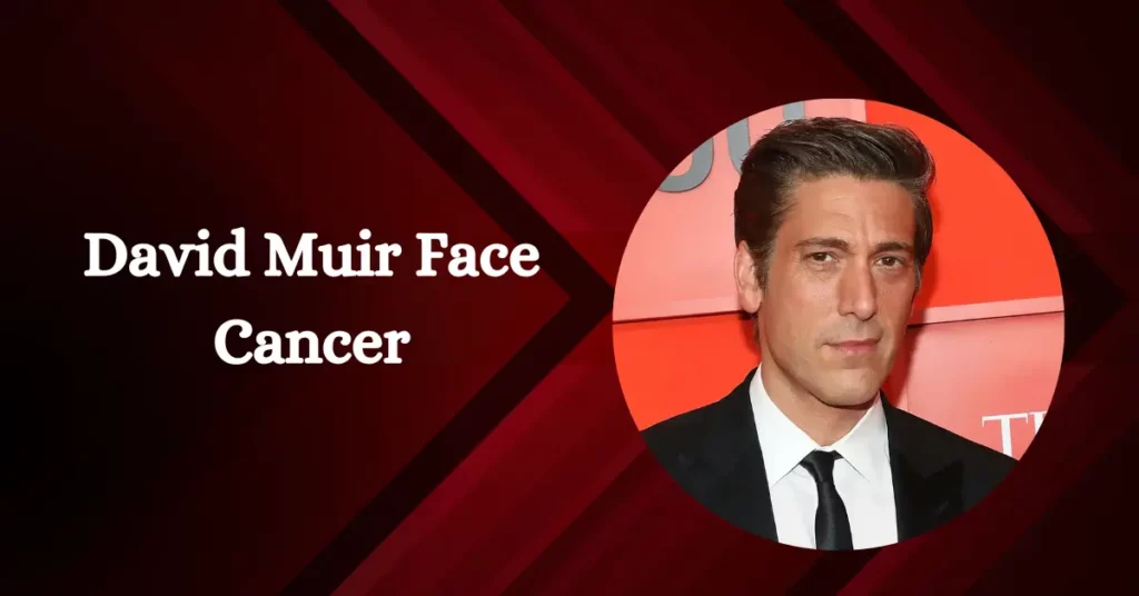 David Muir Face Cancer