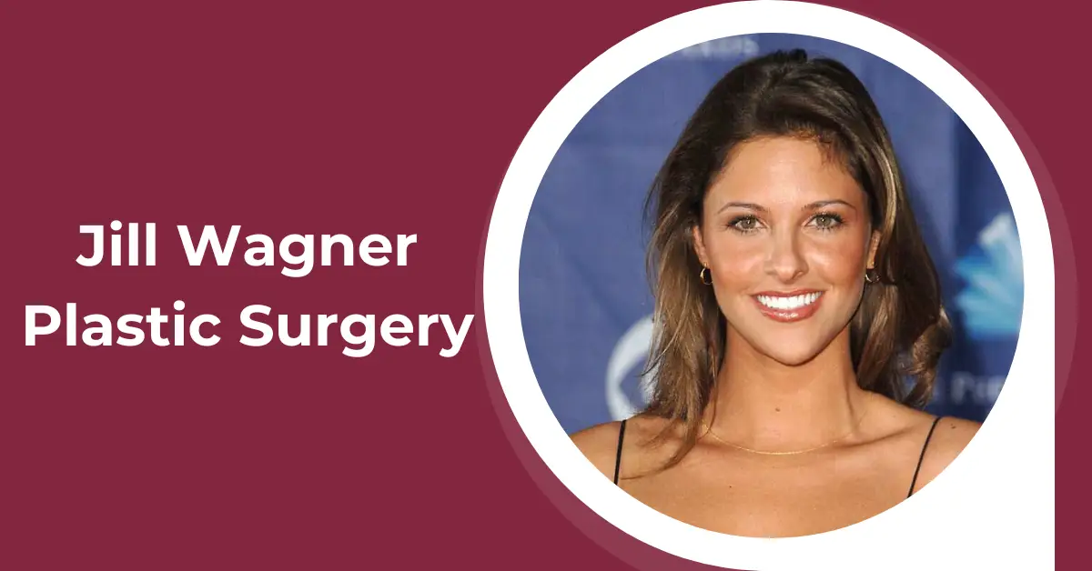 Jill Wagner Plastic Surgery