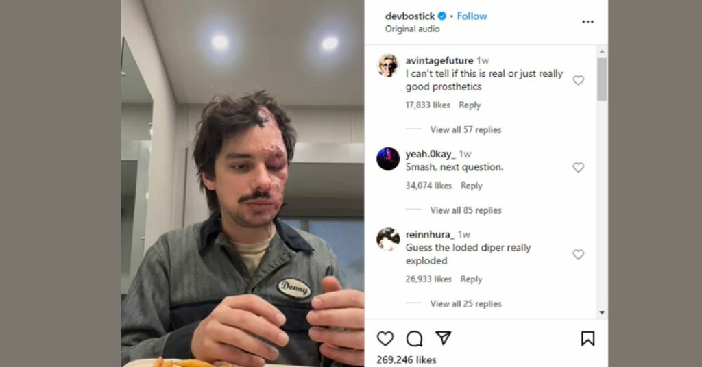 Devon Bostick Accident: What Really Happened Behind this Incident?