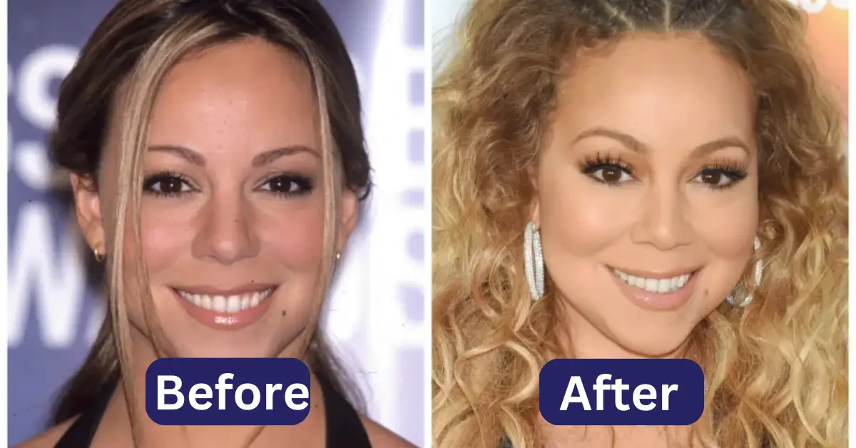 Has Mariah Carey Had Plastic Surgery